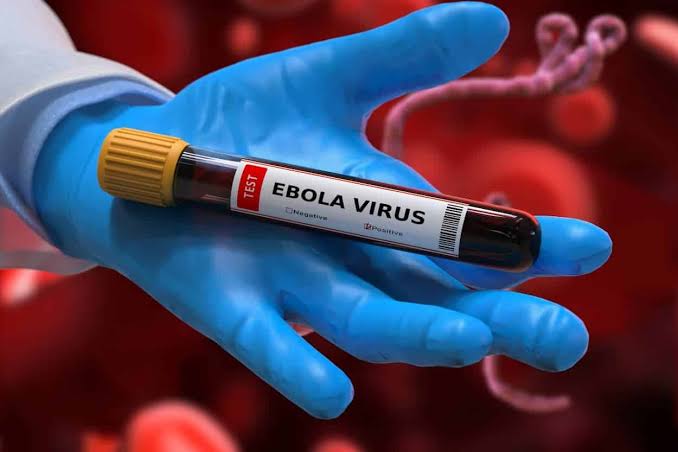 Gli Stati Uniti innalzano il livello di allerta per contrastare la diffusione del virus Ebola